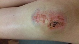 Knee 1.jpg