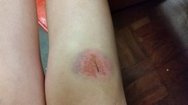 knee 2.jpg