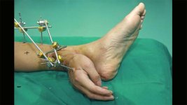 hands and feet.jpg