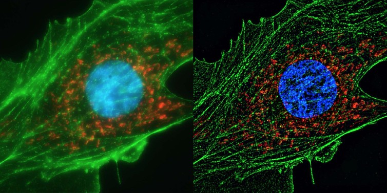 human-cell